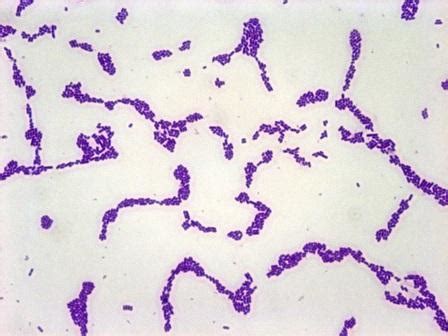 Listeria was discovered by a scottish ok now, l. Lab 4 Coryne
