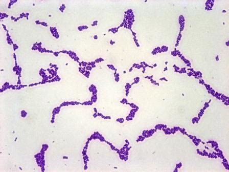 It grows best at temperatures of 30 to 37°c, but it grows well at colder (refrigerator) temperatures in clinical specimens, l. Lab 4 Coryne