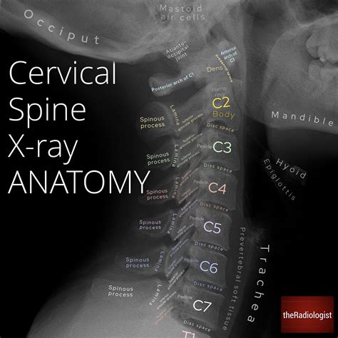 Cervical Spine X Ray Anatomy By Dr Naveen Sharma Grepmed