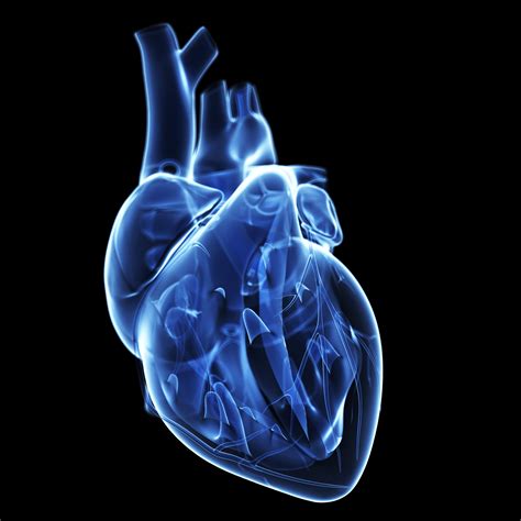 ¿qué es la miocardiopatía hipertrófica? ¿Qué es la miocardiopatía hipertrófica?