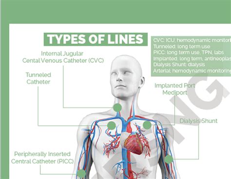 Central Venous Catheters Central Lines Cheat Sheet Medical Estudy