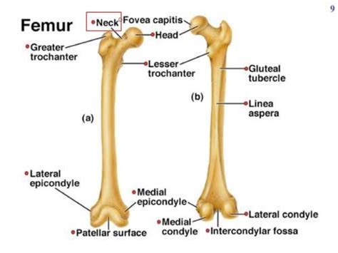 Fracture Neck Of Femur