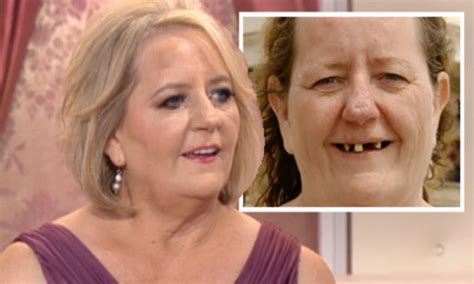 Toothless Grandmother 48 Who Called Herself Fat And Ugly Is