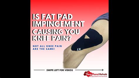 Is Fat Pad Impingement Causing You Knee Pain Youtube