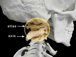 Axis definition, the line about which a rotating body, such as the earth, turns. Neuronas enlatadas: Garrote vil