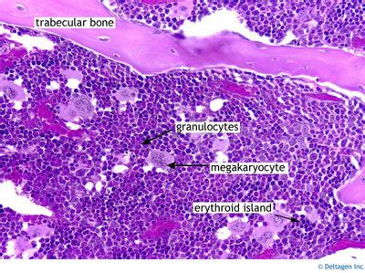 Check spelling or type a new query. Hematopoiesis and Bone Marrow Histology - Bone marrow ...