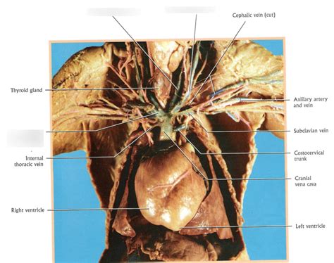 Lab 3 Veins Of Head Neck And Thoracic Cavity Fetal Pig Diagram