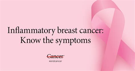For this reason, inflammatory breast cancer is always stage 3 or 4 at the time of diagnosis. Inflammatory breast cancer symptoms: What to know | MD ...