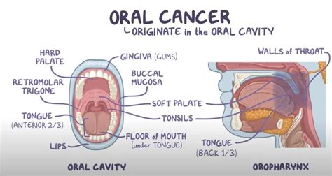 Oral Cancer Symptoms Causes Treatments And More