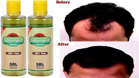 Sbl jaborandi hair oil products on the site are advanced formulations of rich minerals such as keratin, formaldehyde keratin protein, and more, that nourish your hair and treat it in the best. Jaborandi Hair Treatment - Doctor Heck