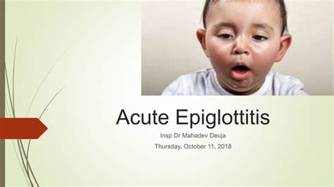 Acute Epiglottitis Ppt