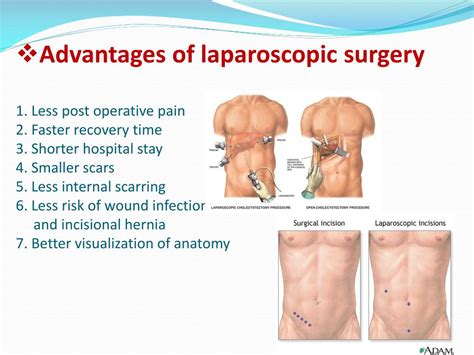 Ppt Basic Principles Of Laparoscopic Surgery Powerpoint Presentation D