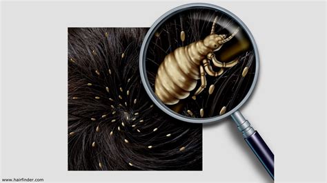 Head Lice Treatments Solutions To Rid Hair Of Lice And Nits