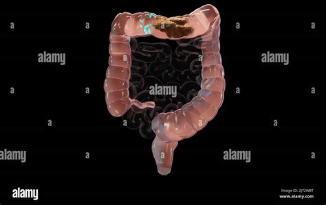 3d Illustration Of Human Digestive System Anatomy Concept Of The