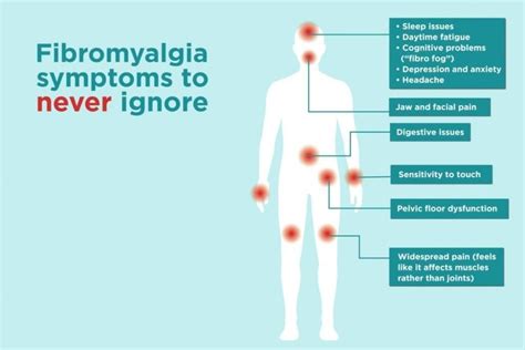 Fibromyalgia 102 Pain Medicine Group Interventional Pain Medicine