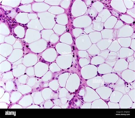Adipose Tissue Light Micrograph Stock Photo Alamy