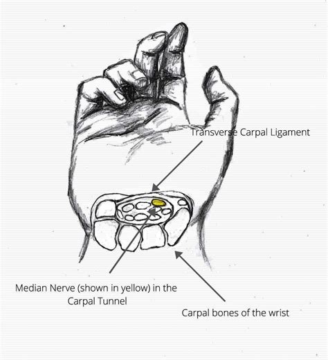Carpal Tunnel With Labels Specialised Hand Therapy