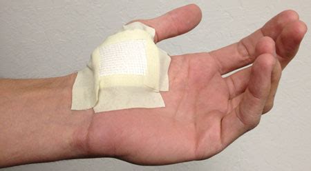 Gels soothe the area by cooling it off. A Memorable (And Funny) Thanksgiving Story About My Ex ...