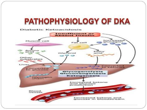 Published by scholars crossing, 2015. PPT - A CASE PRESENTATION OF A PATIENT WITH DIABETIC ...