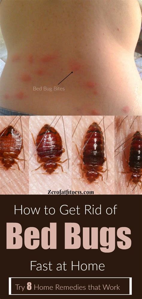 15 How Toget Rid Of Bed Bugs Png