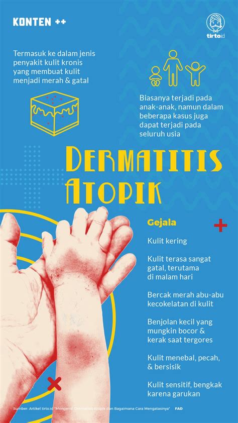 Apa Itu Dermatitis Atopik Definisi Dan Maknanya Kesihatan The The