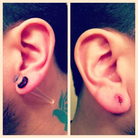I Have One Ear At 0g And Another Thats Crazy Infected P Flickr