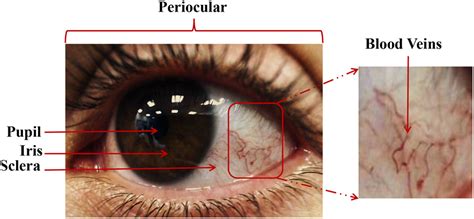 Sclera Recognition On The Quality Measure And Segmentation Of Degraded