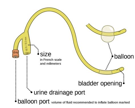 8 you hear a husband and wife discussing what to call their new baby. File:Foley catheter inflated and deflated EN.svg ...