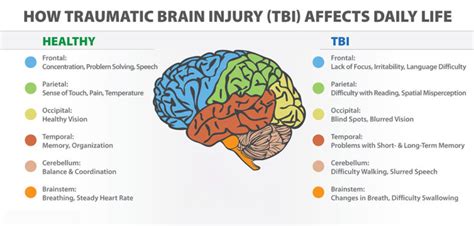 Traumatic Brain Injury Tbi Definition Epidemiology