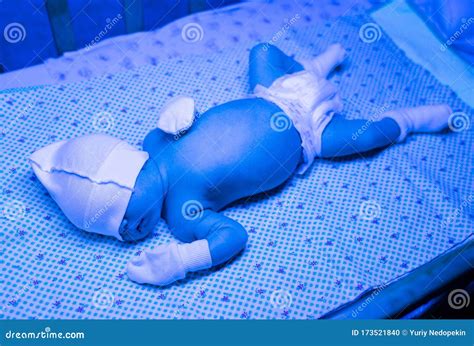 Newborn Having A Treatment For Jaundice Under Ultraviolet Lamp In Home