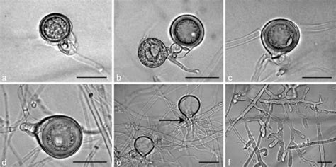 Ad Oogonia Of Phytophthora Multivora With Paragynous Antheridia And