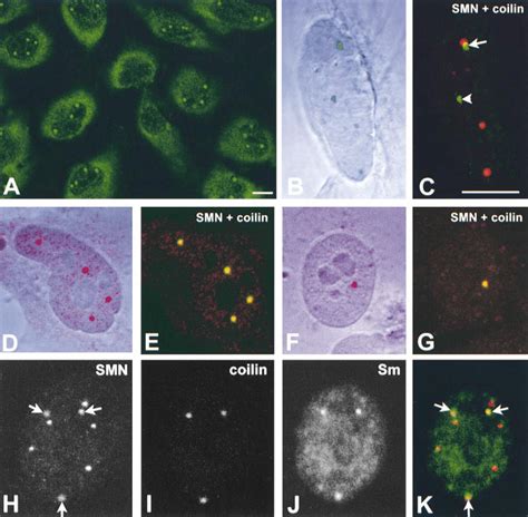 Check spelling or type a new query. Localization of SMN in human cell lines. (A) HeLa cells ...