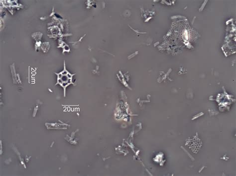 Diatomaceous Earth Celite 535 Under The Microscope