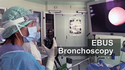 Ebus Bronchoscopy A Test For Lung Cancer Staging Youtube