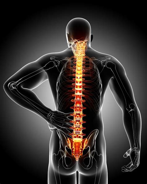Back Injuries Back Sprain Symptoms And Treatment