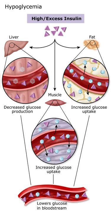 Experiencing stomach pain, nausea, or vomiting. How To Lower Blood Sugar Level | Diabetes Inc.