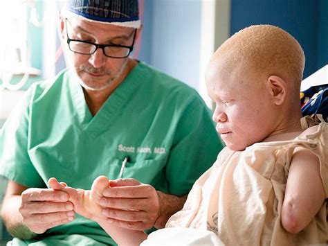 African Children With Albinism Hunted For Limbs In Tanzania