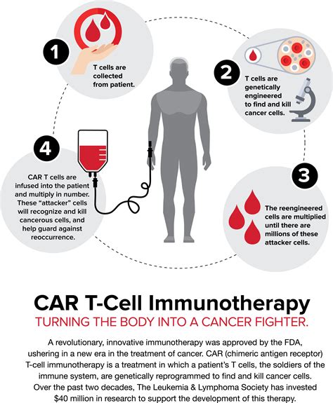 Car T Cell Immunotherapy Leukemia And Lymphoma Society