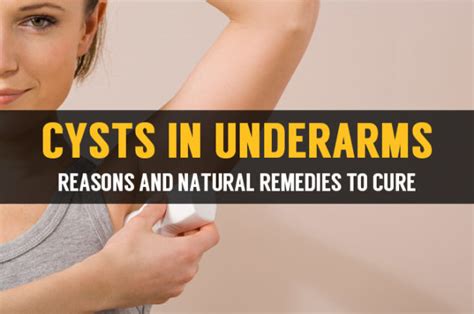 Armpit Cyst And Learn How To Treatment Of Underarm Cyst