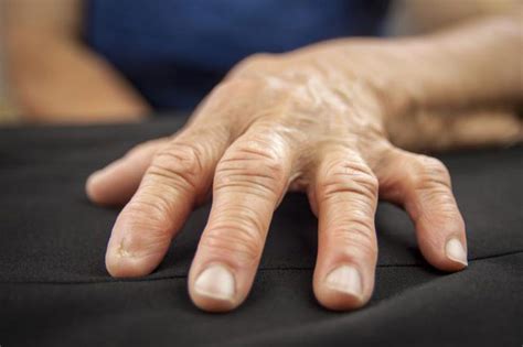 You deserve a reward for giving me such a great blow job in the car. Arthritis in Fingers
