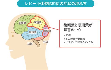 【動画解説】 日本でもっとも行われている認知機能検査「長谷川式認知機能検査」です。 ご自宅でもリアルにできるように作成しております。 運営者：【brain fit.】 「あなたの脳を守る、育てる」を合言葉に、全ての人が認知症に困らないような社会の実現を目指し. 認知症のメカニズム | 認知症予防習慣