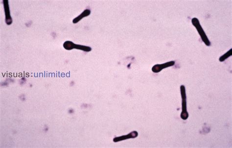 Clostridium Tetani Bacteria Lm Visuals Unlimited