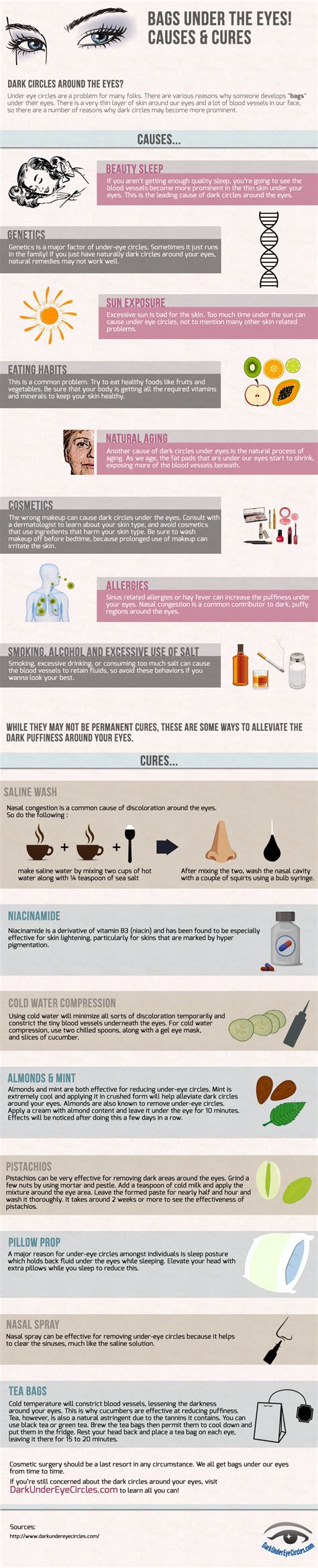 Dark Circles Under Eyes Common Causes And Cures Infographic