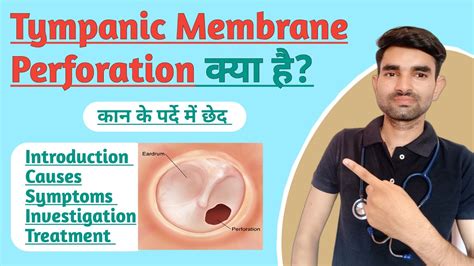 Tympanic Membrane Perforation In Hindi Causes Symptoms And Treatment