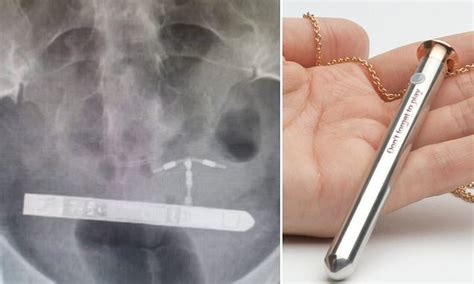 woman is rushed into surgery after a vibrator gets stuck in her bladder and it was still