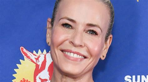 Chelsea Handler Reveals Injuries After Getting Into A Skiing Accident