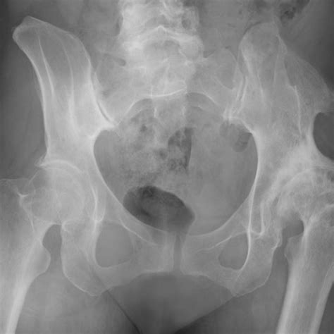 Expertise Streamlines Care For Hip And Knee Arthroplasty