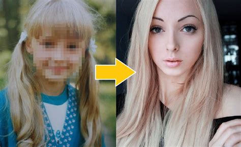 Real Life Barbie Swears Shes All Natural Reveals Childhood Photos As