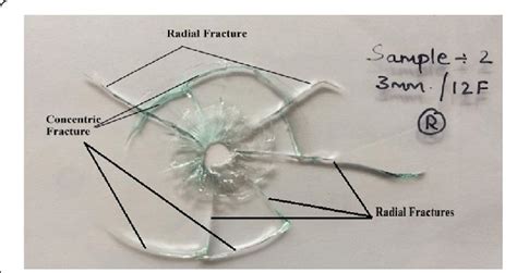 Radial And Concentric Fractures Download Scientific Diagram