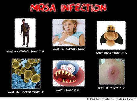 What People Think A Mrsa Infection Is Mrsa Personal Protective